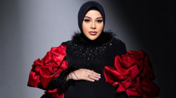 Baby Azzura Miliki Bibir Serupa Dirinya, Aurel Hermansyah Bantah Isu Filler