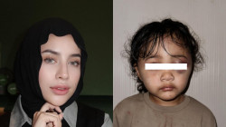 Aghnia Punjabi Bagikan Kondisi Terkini Putrinya Usai Dianiaya Pengasuh