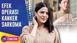 Alice Norin Bagikan Kondisi Kesehatan Paska Operasi Kanker Sarkoma | CUMICAM