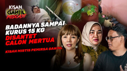 Tega!!! Disantet Sampai Mati Suri Dan Tubuhnya Kering Kerontang Kurus Hanya 15 kilogram