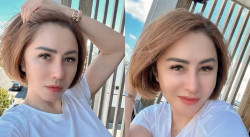 Tak Tegur Teman Dekat, Femmy Permatasari Akui Amnesia Usai Alami Koma