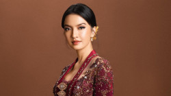 Raline Shah Akui Pernah Alami Kelumpuhan di Wajah, Ini Penyebanya