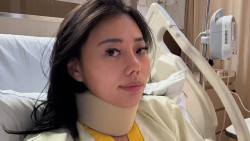 Wendy Walters Beberkan Kondisinya Usai Ditubruk Jet Ski di Danau Toba