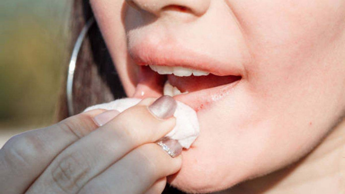 7 Kesalahan yang Tanpa Sadar Bisa Membuat Bibirmu Kering