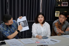 Kisah Miris! Pasien Korban Dugaan Malapraktik Tempuh Jalur Hukum Usai Ditemuakan 2 Jarum Utuh Tertinggal Di Tubuh Paska Operasi