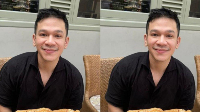 Jordi Onsu Blak-blakan Ungkap Alasan Lakukan Operasi Plastik